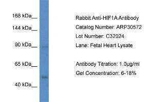 WB Suggested Anti-HIF1A Antibody   Titration: 1. (HIF1A antibody  (N-Term))