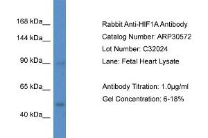 Western Blotting (WB) image for anti-Hypoxia Inducible Factor 1, alpha Subunit (Basic Helix-Loop-Helix Transcription Factor) (HIF1A) (N-Term) antibody (ABIN2779347)
