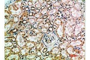 Immunohistochemical analysis of paraffin-embedded human-kidney, antibody was diluted at 1:200 (KIR3DL2 antibody  (AA 221-270))