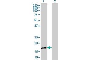 Western Blot analysis of FGF1 expression in transfected 293T cell line by FGF1 MaxPab polyclonal antibody. (FGF1 antibody  (AA 1-155))