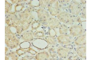 Immunohistochemistry of paraffin-embedded human kidney tissue using ABIN7142361 at dilution of 1:100 (MRPL18 antibody  (AA 14-180))