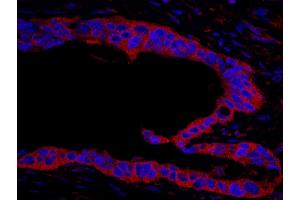 Immunofluorescence (IF) image for anti-Ribosomal Protein S6 Kinase, 90kDa, Polypeptide 1 (RPS6KA1) (AA 375-425) antibody (ABIN7449017)
