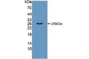 Detection of Recombinant TNFSF9, Human using Polyclonal Antibody to Tumor Necrosis Factor Ligand Superfamily, Member 9 (TNFSF9) (TNFSF9 antibody  (AA 42-253))
