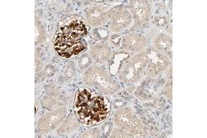 Immunohistochemical staining of human kidney with TPPP2 polyclonal antibody  shows strong cytoplasmic and nuclear positivity in cells in glomeruli.