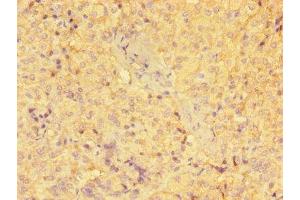 Immunohistochemistry of paraffin-embedded human adrenal gland tissue using ABIN7154103 at dilution of 1:100 (GSTM1 antibody  (AA 24-156))