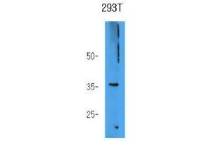 The 293T cell lysate (40 ug) were resolved by SDS-PAGE, transferred to PVDF membrane and probed with anti-human AKR7A3 antibody (1:1000). (AKR7A3 antibody)