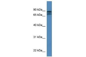 Western Blot showing KLHL22 antibody used at a concentration of 1-2 ug/ml to detect its target protein. (KLHL22 antibody  (N-Term))