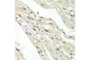 Immunohistochemistry of paraffin-embedded mouse heart using UPF1 antibody. (RENT1/UPF1 antibody  (AA 270-370))