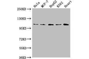 Western Blot Positive WB detected in: Hela whole cell lysate, MCF-7 whole cell lysate, HepG2 whole cell lysate, K562 whole cell lysate, Mouse heart tissue All lanes: OPA1 antibody at 1:2000 Secondary Goat polyclonal to rabbit IgG at 1/50000 dilution Predicted band size: 112, 116 kDa Observed band size: 112 kDa (OPA1 antibody  (AA 183-351))