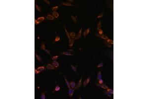 Immunofluorescence analysis of NIH-3T3 cells using USP30 Polyclonal Antibody (ABIN6131133, ABIN6150017, ABIN6150018 and ABIN6216645) at dilution of 1:100 (40x lens). (Usp30 antibody  (AA 57-390))