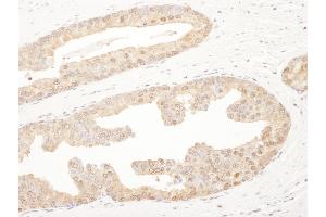 Immunohistochemistry (IHC) image for anti-Proteasome Subunit alpha 6 (PSMA6) (AA 196-246) antibody (ABIN7453443)