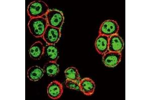 Confocal immunofluorescent analysis of phospho-SMAD3 antibody with HeLa cells followed by Alexa Fluor 488-conjugated goat anti-rabbit lgG (green).