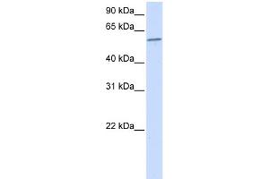 WB Suggested Anti-PPP3CA Antibody Titration:  0. (PPP3CA antibody  (N-Term))