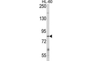 Western Blotting (WB) image for anti-Cbl Proto-Oncogene B, E3 Ubiquitin Protein Ligase (CBLB) antibody (ABIN3003861)