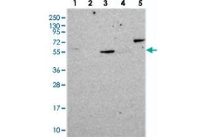Western blot analysis of Lane 1: RT-4, Lane 2: U-251 MG, Lane 3: Human Plasma, Lane 4: Liver, Lane 5: Tonsil with CORO2A polyclonal antibody .