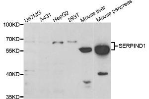 Western blot analysis of extracts of various cell lines, using SERPIND1 antibody (ABIN5973459) at 1/1000 dilution. (SERPIND1 antibody)