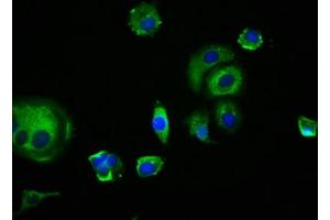 Immunofluorescence staining of MCF-7 cells with ABIN7173899 at 1:166, counter-stained with DAPI. (EDAR antibody  (AA 27-170))