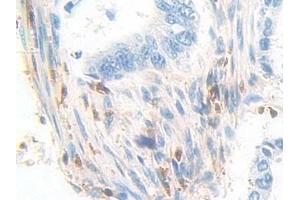 Immunohistochemistry (IHC) image for anti-Pyridoxal Kinase (PDXK) (AA 29-253) antibody (ABIN7440257)