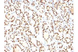 Formalin-fixed, paraffin-embedded human Thyroid stained with TTF-1 Mouse Monoclonal Antibody (8G7G3/1). (NKX2-1 antibody)