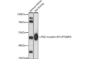 Western blot analysis of extracts of various cell lines, using PGE receptor EP3 (PTGER3) antibody (ABIN1682372, ABIN3018477, ABIN3018478 and ABIN6220477) at 1:3000 dilution. (PTGER3 antibody  (AA 1-53))