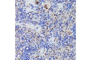Immunohistochemistry of paraffin-embedded rat spleen using CDC23 antibody (ABIN7266248) at dilution of 1:100 (40x lens). (CDC23 antibody  (AA 50-150))