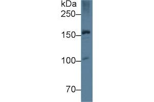 Detection of APOB in Rat Liver lysate using Monoclonal Antibody to Apolipoprotein B (APOB) (APOB antibody  (AA 2747-2913))
