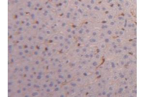 Detection of FABP4 in Mouse Liver Tissue using Polyclonal Antibody to Fatty Acid Binding Protein 4 (FABP4) (FABP4 antibody  (AA 2-132))