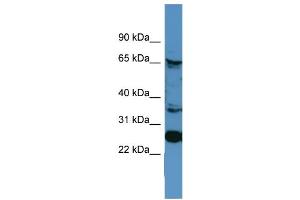 WB Suggested Anti-CANX  Antibody Titration: 0. (Calnexin antibody  (C-Term))