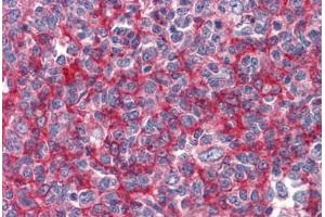 Human Tonsil: Formalin-Fixed, Paraffin-Embedded (FFPE) (GBP1 antibody  (AA 1-593))
