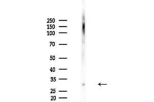 anti-Lin-28 Homolog B (LIN28B) (pSer203) antibody
