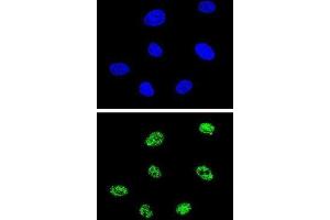 Immunofluorescence (IF) image for anti-Tumor Protein P73 (TP73) antibody (ABIN3003949) (Tumor Protein p73 antibody)