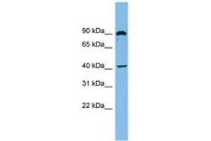 Image no. 1 for anti-Zinc Finger, MYND Domain Containing 12 (ZMYND12) (AA 35-84) antibody (ABIN6744891) (ZMYND12 antibody  (AA 35-84))