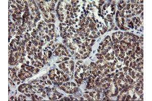 Image no. 1 for anti-Armadillo Repeat Containing 1 (ARMC1) antibody (ABIN1496727) (ARMC1 antibody)