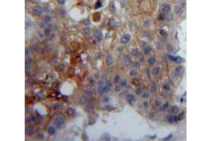 IHC-P analysis of Lung tissue, with DAB staining. (GP5 antibody  (AA 17-242))