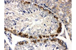 IHC testing of FFPE mouse testis with YB1 antibody. (YBX1 antibody)