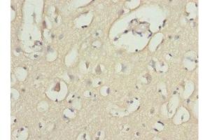 Immunohistochemistry of paraffin-embedded human brain tissue using ABIN7143362 at dilution of 1:100 (MOCS3 antibody  (AA 271-460))