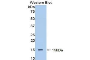 Western Blotting (WB) image for Mannan-Binding Lectin serine Peptidase 2 (MASP2) ELISA Kit (ABIN6574229)