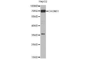 Western blot analysis of extracts of HepG2 cells, using CACNB1 Antibody. (CACNB1 antibody  (AA 429-598))