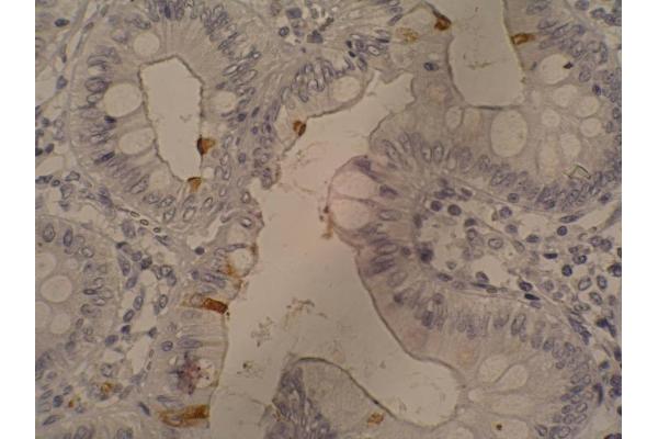 CA 19-9 antibody
