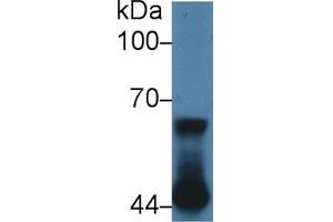 Detection of NUP62 in Human A431 cell lysate using Polyclonal Antibody to Nucleoporin 62 (NUP62) (NUP62 antibody  (AA 186-432))