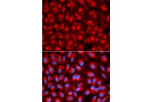 Immunofluorescence analysis of U2OS cell using TFAM antibody. (TFAM antibody)