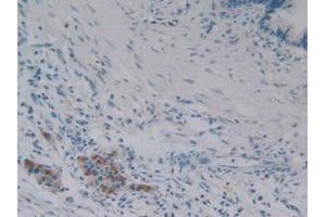 Detection of iPLA2 in Human Pancreas Tissue using Polyclonal Antibody to Phospholipase A2, Calcium Independent (iPLA2) (PNPLA2 antibody  (AA 484-701))