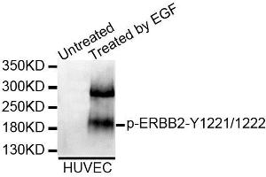 Western blot analysis of extracts of HUVEC cell line, using Phospho-ERBB2-Y1221/1222 antibody (ABIN5995602). (ErbB2/Her2 antibody  (pTyr1221, pTyr1222))