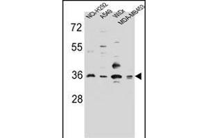 RIC3 Antibody (C-term) (ABIN656649 and ABIN2845890) western blot analysis in NCI-,A549,WiDr,MDA-M cell line lysates (35 μg/lane). (RIC3 antibody  (C-Term))
