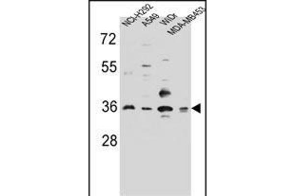 RIC3 Antikörper  (C-Term)