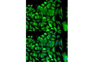 Immunofluorescence analysis of HeLa cells using PGK1 antibody (ABIN5971017). (PGK1 antibody)