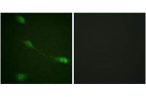 Immunofluorescence analysis of NIH-3T3 cells, using MDM2 (Ab-166) Antibody. (MDM2 antibody  (AA 132-181))