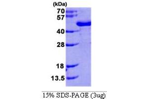 SDS-PAGE (SDS) image for N-Acetyltransferase 6 (GCN5-Related) (NAT6) (AA 1-308) protein (His tag) (ABIN6386511) (NAT6 Protein (AA 1-308) (His tag))