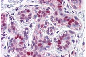 Human Breast: Formalin-Fixed, Paraffin-Embedded (FFPE) (LMO4 antibody  (AA 1-166))