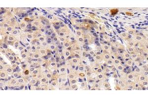 Detection of MPIF2 in Mouse Stomach Tissue using Polyclonal Antibody to Myeloid Progenitor Inhibitory Factor 2 (MPIF2) (CCL24 antibody  (AA 27-119))